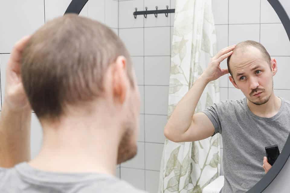 Problème de perte de cheveux | Calvitie chez l'homme